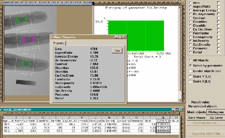 Bone Density Estimation