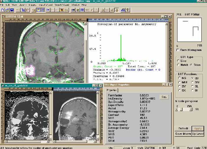 Brain MRI